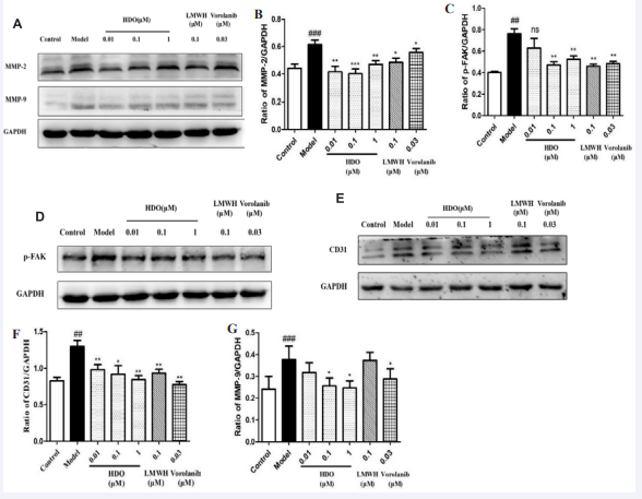 The effect of HDO on the expression of MMP-2/-9, P-FAK, and CD31 in HUVEC cells by Western Blotting