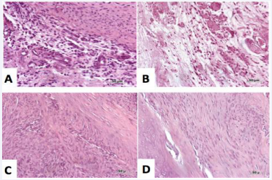  Representative histological photographs of hematoxylin and eosin stained slides at 3 days (top row) and 4 weeks (bottom row). There is a modification from a disorganized tissue to a more organized dense connective tissue. (A) 3 days PRP; (B) 3 days PRP and ASCs; (C) 4 weeks PRP; (D) 4 weeks PRP and ASCs.