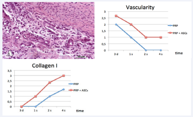 Evolution of the concentrations of vessels and collagen in the preparations