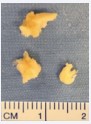 Figure 7 Macroscopic aspect of the ossicle fragments.