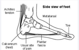 Figure 1 Lateral anatomical view of the plantar fascia.