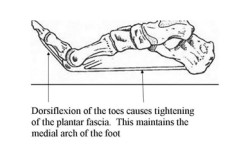 Figure 2 Windlass mechanism of the plantar fascia.