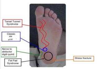 Figure 4 Differential diagnosis and site of pain.