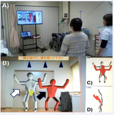 Figure 1 Scenes using our AR-supported exercise therapy system  (A) The participant exercises in front of a video monitor equipped with an infrared camera.  (B) Two skeletal polygons are displayed in the augmented reality (AR) space on the monitor [teaching polygon, white arrows; the patient’s doppelganger polygon, black  arrow]. The patient practices exercises taught by the teaching polygon, and visually confirms the difference between exercise postures of them on the main monitor. They  can real-timely check precautions, which were presented if the differences of exercise postures are large, during exercising at the top of the monitor [Dark blue arrow  heads indicate “Bending knees, and stoop down” in Japanese]. (C) To easier understand the differences of the participant’s postures during practicing exercises from the teaching polygon, two sub-windows (C) and (D) are also  presented in the monitor. In these sub-windows, the polygons are superimposed in the front (C) and lateral (D) views.