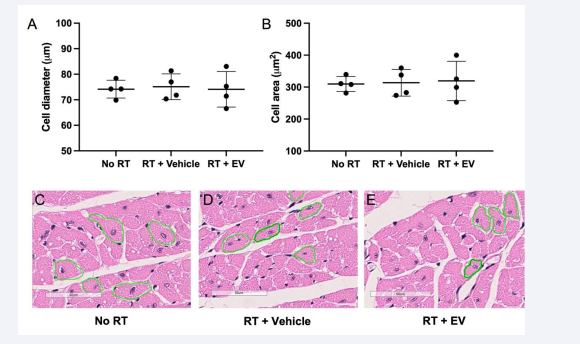 Cell diameter (?m) (A) and cell area (?m2) (B) of cardiomyocytes 24 weeks post exposure to a sham irradiation (No RT) or 14 Gy single dose  to the whole thorax and treatment with 4 i.v. injections of hESC-derived EV (RT+ EV) or PBS (RT + Vehicle). Mean ± SD. Individual cardiomyocytes  were circumscribed to calculate length and area of a minimum of sixty measurements per animal on non-irradiated controls (No RT; C), animals  irradiated and treated with vehicle (RT + Vehicle; D) and animals irradiated and treated with EV (RT+EV; E).