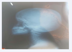 Skull and cervical x-ray of the patient.