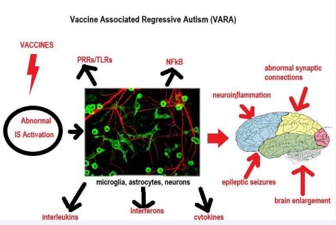 Interplay between abnormal immune system (IS) responses to vaccines, inflammatory activation of neural cells, and functional brain impairments associated  with vaccine associated regressive autism (VARA). (PRRs: pattern recognition receptors; TLRs: Toll-like receptors; NFkB: nuclear factor kappa B.) (Photo credit: Mixed  rat brain cultures stained for coronin 1a, found in microglia here in green, and alpha-internexin, in red, found in neuronal processes, Gerry Shaw, 2005, CC-SA 3.0.) (Brain  image credit: Henry Vandyke Carter, in Gray’s Anatomy, Lea and Febiger Publisher, 1918-in public domain.)