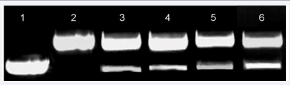 Effect of the selected active compounds 10a, 10e and 10u on Topo I inhibition (Lane 1-DNA alone, Lane 2-DNA + Topo I, Lane 3-DNA + Topo  I + 10a, Lane 4-DNA + Topo I + 10e,Lane 5-DNA+Topo I + 10u, Lane 6-DNA+Topo I + camptothecin). In this assay 0.5 µg of DNA was incubated with  1 unit of topo I enzyme and Camptothecin (control) and ?-carboline conjugates 10a, 10e and 10u at 25 µM were added to the Topo I-DNA complex  and incubated at 37 oC for 30 min.
