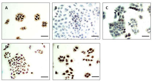 Determination of the sensitivity of antibodies to BRG1. The lung cancer-derived cell line H460 was used as a positive control to assess the sensitivity of various BRG1 antibodies: sc-374197 (A), sc-17796 (B), sc-10768 (C), LS-B5107 (D) and 21634-1-AP (E). All images are at 63x magnification. Scale bar=20µm.