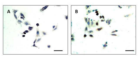 Panel B. A BRG1 antibody that lacks specificity to BRG1. ICC with sc-10768 and lung cancer-derived A549 cells shown in (A) and (B), illustrate that this antibody is non-specific for BRG1, as A549 cells expression BRM but not BRG1. 63x magnification. Scale bar=20µm.