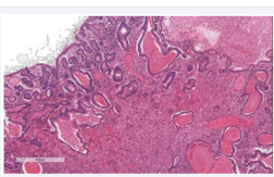 Figure 2 Hematoxylin-eosine staining.