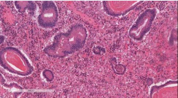 Figure 3 Hematoxylin-eosine staining