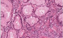 Figure 4 Hematoxylin-eosine staining.