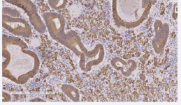 Figure 5 Immunohistochemistry study.