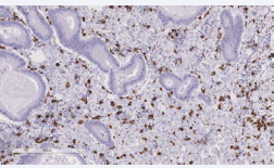 Figure 6 Immunohistochemistry study.