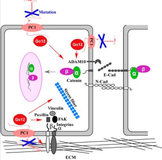 Schematic diagram of the G?12 and PC1 signaling in renal  cystogenesis. PC1 complexes are located in apical, baso-lateral regions  of renal epithelial cells. Mutation of PC1 activates G?12. It increases  the activation of ADAM10 that promotes the shedding of E-cadherin,  which subsequently releases catenins that translocate into nucleus  and trigger certain gene expression. Eventually it changes cell polarity,  cell-cell adhesion, and growth behavior. In addition, mutation of  PC1 and activation of G?12 also affect N-cadherin, cell-cell adhesion  (integrin-mediated focal adhesion), stress fiber, extracellular matrix  (ECM) accumulation, and interstitial fibrosis. All of these favor the  development of kidney cysts. Blue cross: mutation or inactivation; Red  arrow: activate; grey arrow: translocate