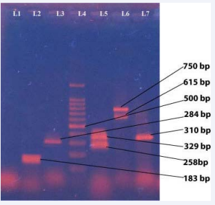 Figure 1 Photograph of amplified DNA of different serotypes of  Salmonella. Negative control Esch. coli ATCC 25922 (lane 1). Amplified  DNA of 183 bp for fliC gene of Salmonella Typhimurium. (lane 2), 284  bp for invA gene of Salmonella spp. (lane 3), 329 bp and 258 bp for fliC and prt gene of Salmonella Paratyphi A (lane 5), 750 bp and 615 bp  for fliC and tyv gene of Salmonella Typhi respectively (lane 6) and 310  bp for sefA gene of Salmonella Enteritidis (lane 7). Hundred base pair  DNA (lane 4).