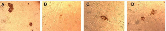 Figure 4 Pancreatic islets of animals in different groups, Magnification-800? A – The passive control group B – The active control group C – The experimental group treated by lithium chloride D – The experimental group treated by lithium carbonate