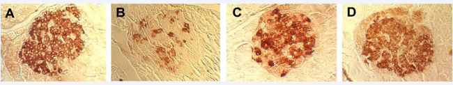 gure 5 Pancreatic islets of animals in different groups. Magnification-1600? A – The passive control group B – The active control group C – The experimental group treated by lithium chloride D – The experimental group treated by lithium carbonate