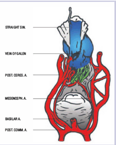 Figure 4: Mesencenphalic Artery VGM(ALpers and Forrester)