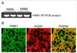 PINK1 is expressed in pancreatic islet cells and MIN6 cells. (A) Expression of PINK1 mRNA in mouse pancreatic islets and the MIN6  pancreatic ?-cell line. Total RNA was isolated and expression of Pink1 mRNA was  analyzed as described in Materials and Methods. (B) Expression of PINK1 protein in ?-cells of the mouse pancreas. Paraffin  sections of normal mouse pancreas were stained with antibodies against PINK1  (green) and insulin (red) and imaged by confocal microscopy as described in  Materials and Methods. Scale bar, 20 µm