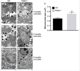 Mitochondrial swelling in PINK1-deficient pancreatic ? –cells:  Pancreata were embedded, processed and cut for analysis by electron microscopy  as described in Materials and Methods. (A-F) Electron microscopy images of  mitochondria in pancreatic ?-cells of 4-month and 8-month old WT (A,C,E) and  PINK1-/- (B,D,F) mice (fold magnification indicated). (G) Statistical analysis of  mitochondrial size. Thirty-seven to sixty-seven randomly chosen mitochondria  in pancreatic ?-cells were analyzed at 49,000x magnification using NIH Image J  software for n=3 mice per genotype and the means were compared by t-test. WT  mice, black bars; PINK1-/- mice, grey bars; mean ± SD; **p<0.01). In panels B, D  and F arrows point to enlarged/swollen mitochondria with cristae fragmentation.  Asterisks in panels A- D indicate insulin granules. Scale bars, 0.5 µm