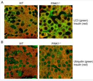 Increased numbers of autophagosomes and ubiquitin-positive  inclusions in pancreatic ? -cells of PINK1-/- mice: Paraffin sections of  pancreata were stained with antibodies against (A) LC3 and insulin to detect autophagosomes and (B) ubiquitin and insulin  to detect ubiquitinated inclusions in ?-ells. Panels show overlays of green  (Alexa488) and red (Alexa594) signals captured by confocal microscopy and are  representative of three animals per genotype