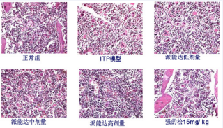 Bone marrow pathological section examination of PND treating each  ITP mouse model.