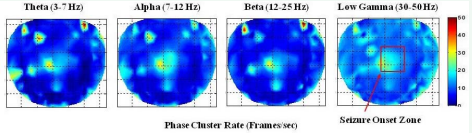  Contour plots of stable phase cluster rate (frames/sec). The seizure onset area is marked as a rectangle. The rate is higher in and in the vicinity of the seizure  onset area