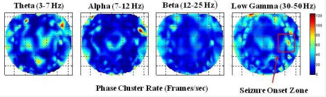  Contour plots of stable phase cluster rate (frames/sec) for the subject #2. It shows higher cluster rate in the theta and low gamma bands.
