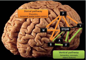 The dual-route hypothesis. The dorsal route (orange) comprises  pathways from the parietal cortex (P) and posterior part of the superior  temporal gyrus (STG/W) to the premotor area (M) and to Broca’s area (B),  connected via the arcuate/superior longitudinal fasciculus. The dorsal route may  process phonetic information to produce verbal output without accessing word  meaning. Word repetition may rely on this route, as evidenced by the phonemic  paraphasia caused by damage to this pathway. The dorsal route may also be  involved when guiding the hand to target objects via temporal spatial control  combined with visual/tactile feedback. Damage to this route may impair gesture  imitation. The ventral route (green) comprises pathways from the superior  temporal gyrus (STG/W) to Broca’s area (B) via the extreme capsule, and from  the anterior part of the superior temporal gyrus (IT) to the frontal operculum  via the uncinate fasciculus [21]. Injury to the ventral pathway may result in  sensory aphasia. It may also cause apraxia accompanied with difficulties with  actual tool use. A, auditory cortex; M, motor-related areas; V, visual cortex.