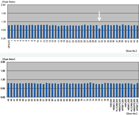 Multiplex ligation-dependent probe amplification analysis of DMD was performed using the patient’s DNA. The peak ratio of every exon was identified within  a set range, but the signal of exon 31 was slightly reduced (white arrow)