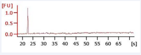 Peripheral Blood 76 y/o patient - Excellent ribosomal RNA Integrity.