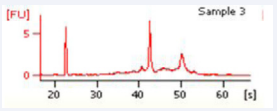 Bone Marrow Aspirate 76 y/o patient - Excellent ribosomal RNA Integrity.