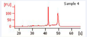 Peripheral Blood 23 y/o patient - Excellent ribosomal RNA Integrity.