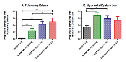 Cardiopulmonary Response by Ischemic Stroke Location. A) Proportion of patients with pulmonary edema varied across stroke groups and was greatest  for patients with large vessel brainstem stroke. B) Myocardial dysfunction was defined as a composite outcome of wall motion abnormalities on echocardiogram, elevated  serum troponin, arrhythmia on admission EKG, and/or QTc-interval prolongation on admission EKG. Myocardial dysfunction also varied in proportion across stroke  groups, and was greatest among patients with large vessel left middle cerebral artery or right cerebral artery strokes involving the insula relative to control and large  vessel brainstem stroke patients. * designates p<0.05 and *** designates p<0.001 by Fisher’s exact test