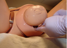 First perform a digital exam. Introduce your dominant  second and/or third fingers from both hands along the fetus to locate  the posterior shoulder and the axilla.