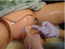 Anterior shoulder release, start with a digital exam searching  for the anterior shoulder then hook your fingers into the axilla and  pull with a continuous steady force downwards and forward, to  release from the symphysis pubis while adducting the shoulder to the  chest anteriorly and pulling in the direction of the head.