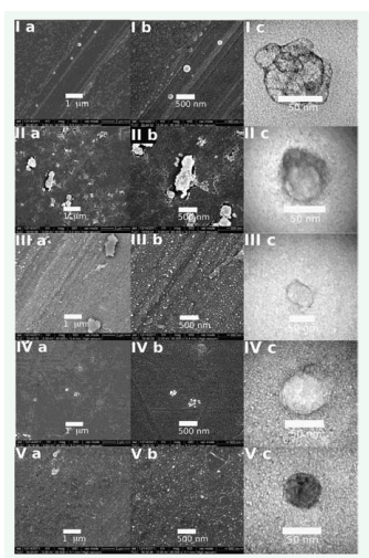 Figure 2 Scanning electron micrographs of: (I) FC-MSToc, (II) FCMSVitD2, (III) FC-MSD, (IV) FC-MSDI31 and (V) FC-MSS7 nanoparticles  at (a) 40000× and (b) 85000× magnifications, c) transmission electron  micrograph at 100000× magnifications with negative staining (see  Figure 1 for structures).