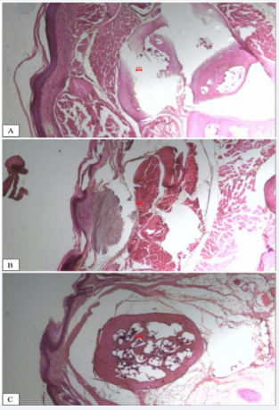 Histomorphometric analysis of the influence of HCE-CS on  skin reorganization parameters (skin thickness and scar length). A:  Casearia; B: vehicle; C: dexamethasone