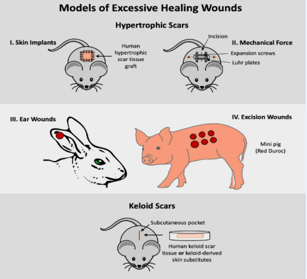 Visual Overview of Models of Excessive Healing Wounds.