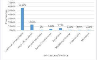 Distribution of skin cancer on the face.