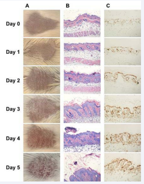 Once daily topical application of IMQ induces psoriasislike dermatitis and hyperproliferative epidermis in BALB/c  mouse. (A) Representative clinical photo. (B) Representative H&E  stain. (C) Representative Ki67 stain.