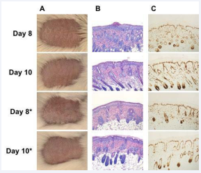 Continued topical application of IMQ in BALB/c mouse  does not sustain psoriasis-like dermatitis. After initial IMQinduction for 5 days, IMQ application was continued once daily or  alternate day (*) from day 6 to day 10. (A) Representative clinical  photo. (B) Representative H&E stain. (C) Representative Ki67 stain.