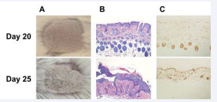 After complete recovery from initial induction, IMQ  can re-induce psoriasis-like dermatitis and hyperproliferative  epidermis in BALB/c mouse. (A) Representative clinical photo. (B)  Representative H&E stain. (C) Representative Ki67 stain.
