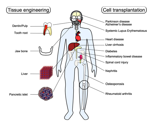  A perspective of human dental pulp-derived stem cell-based regenerative medicine. 