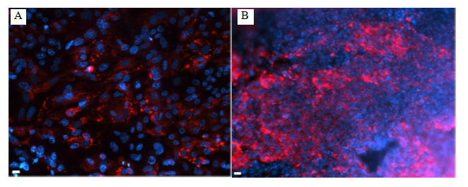 Figure 3: MHC6 protein (red) was visualized in corresponding day 9 differentiating cells by indirect immunofluorescence with a DMI6000B Leica inverted microscope. (A) – Control, (B) – PLDLA-co-TMC. Hoechst (blue) was used to identify nuclei. Scale bar (20 ?m).