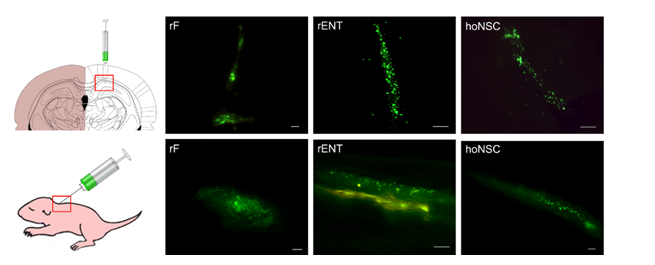 Figure 1: Detection of cells labelled with vital dye CFDA-SE 28 days after implantation into the CA-1 zone of the hippocampus of the contralateral hemisphere of the brain (left part of the Figure) and under the skin of the interscapular region (right part of the Figure) to rat pups with PHIBD. Cryoslices, fluorescent microscopy. Scale bar is 120µm.