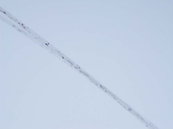 Light microscopy with large, irregular clumps of pigment  throughout the hair shaft.