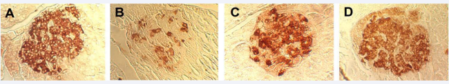  Figure 5 Pancreatic islets of animals in different groups. Magnification-1600?  A – The passive control group  B – The active control group  C – The experimental group treated by lithium chloride  D – The experimental group treated by lithium carbonate